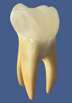 An example of furcation.